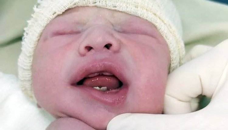 Bebê nasce com dois dentes e surpreende família no PR