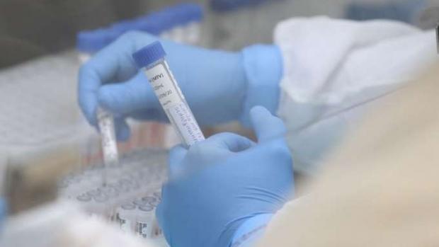 Oito laboratórios estão habilitados para testes do coronavírus no Paraná