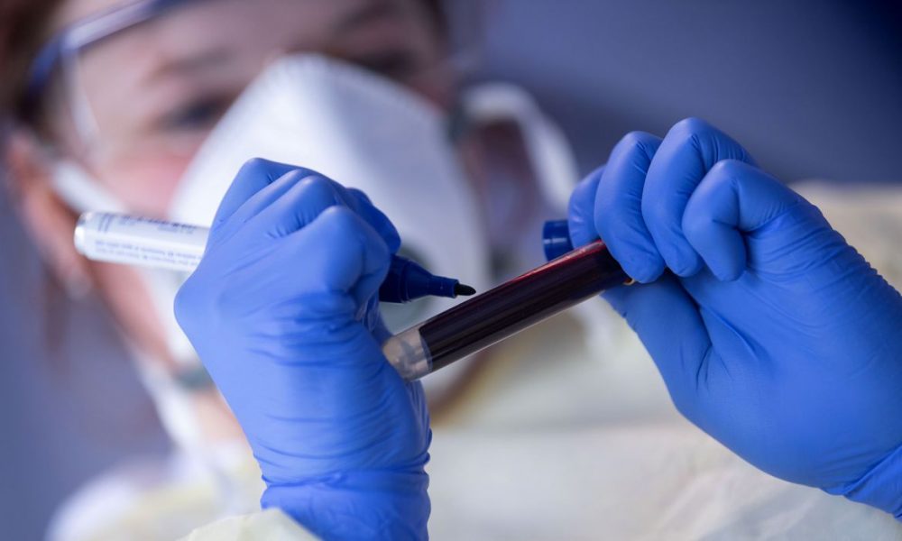 Quase 1 milhão de paranaenses já fizeram teste para detectar coronavírus