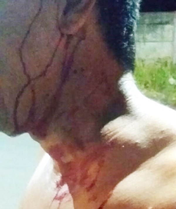 Homem é agredido com coronhada durante roubo de veículo em Goioerê