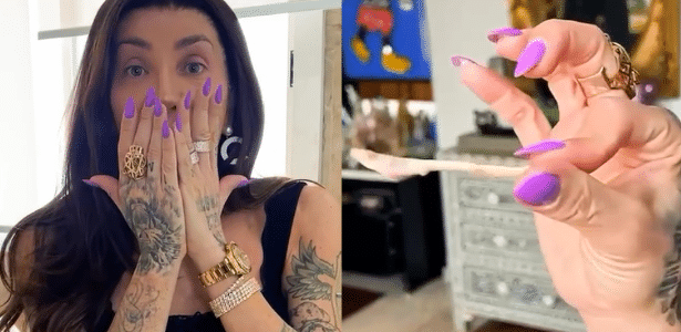 Maya Massafera mostra rosto após retirar ossos do maxilar