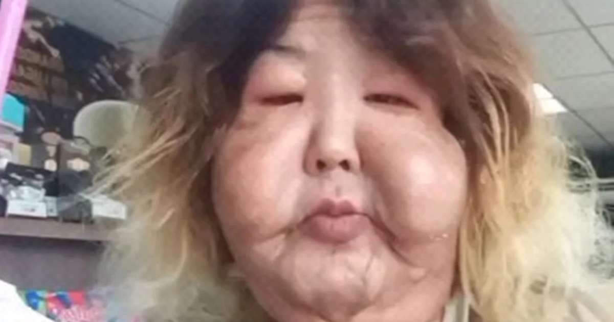 ‘Um corpo é um corpo’