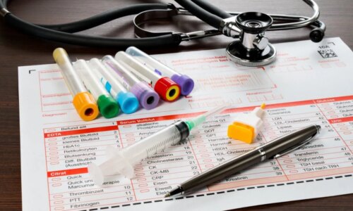 Saiba quais doenças podem ser detectadas em exames de sangue, fezes e urina