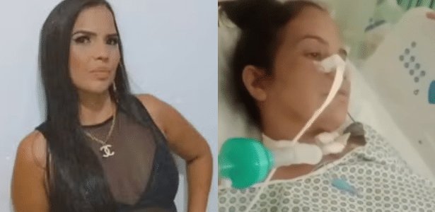 o que é a síndrome de Guillain-Barré