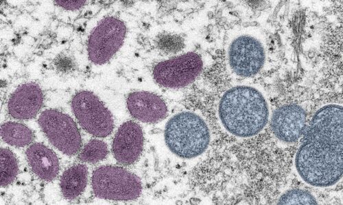 Caso de Mpox é confirmado em Porto Alegre