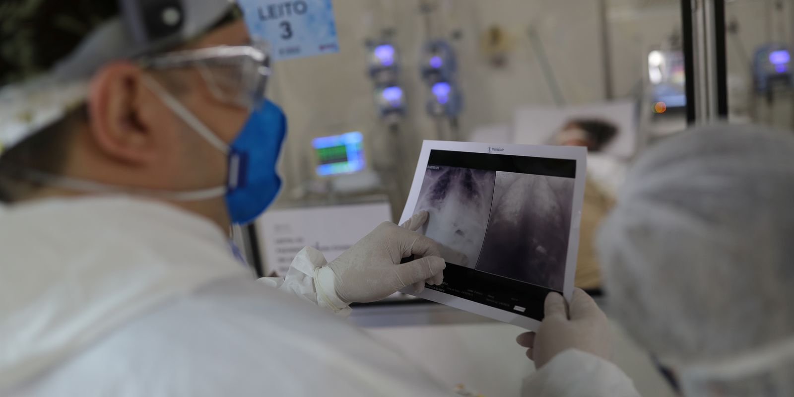 entenda quadro que causou internação de Bolsonaro