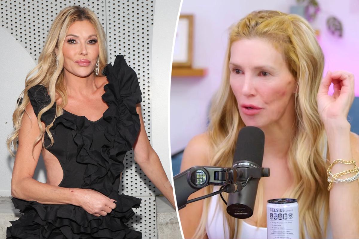 Brandi Glanville thinks she has a ‘sexually transmitted ringworm’ in her throat