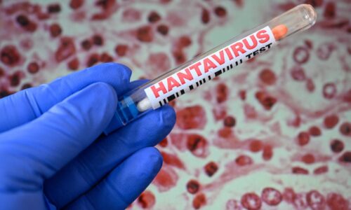Hantavirus outbreak: Little chance says Kalshi